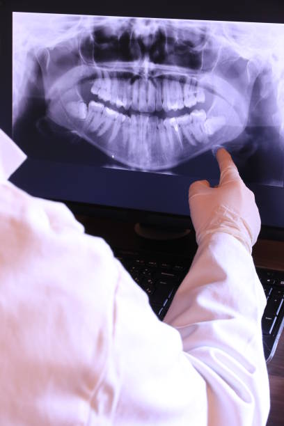 Best Emergency Tooth Extraction in Forty Fort, PA